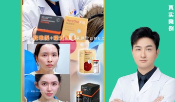 𝐃𝐫 ·陈达院长｜双童颜针 爱唯缇+臻爱塑菲✅ 胶原满格 淡纹紧致一步到位 焕启童颜肌