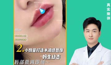 𝐃𝐫 ·陈达院长 告别干瘪薄唇，解锁纯欲天花板