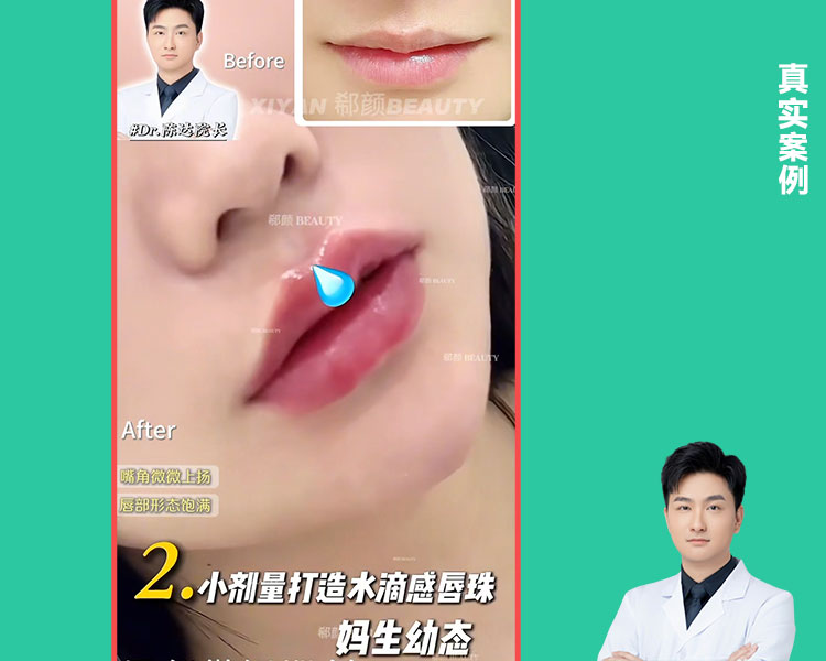 𝐃𝐫 ·陈达院长 告别干瘪薄唇，解锁纯欲天花板